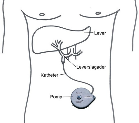 Schematische weergave