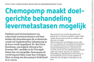 Chemopomp maakt doelgerichte behandeling van levermetastasen mogelijk